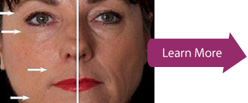 learn more